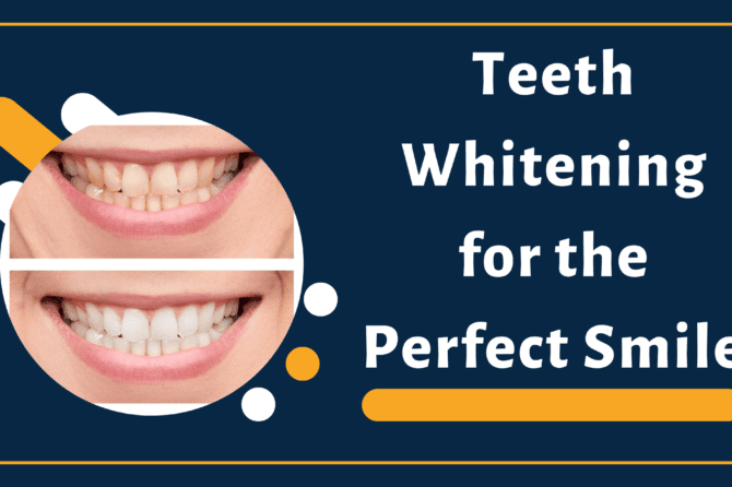 Get the Perfect Smile with Teeth Whitening
