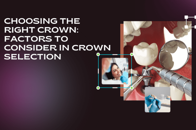 Choosing the Right Crown: Factors to Consider in Crown Selection