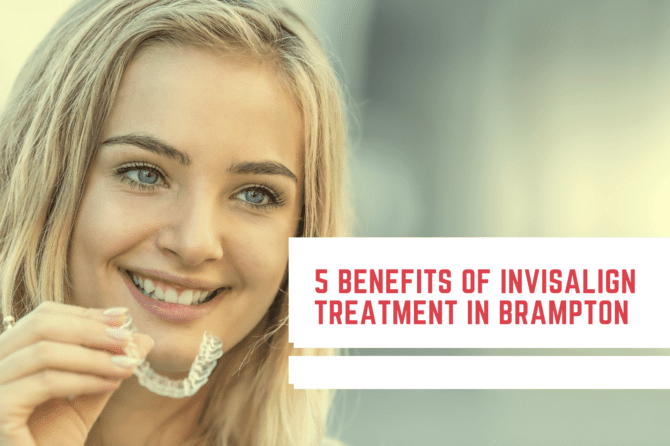 The 5 Benefits of Invisalign Treatment in Brampton