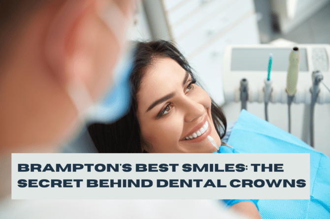 Brampton’s Best Smiles: The Secret Behind Dental Crowns