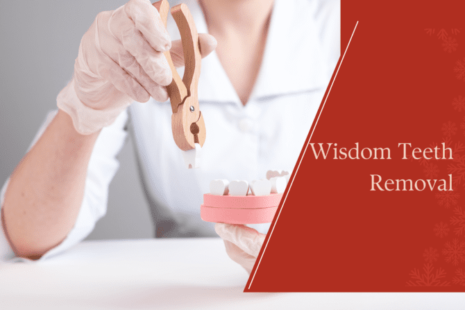 Is Wisdom Teeth Removal Always Necessary?