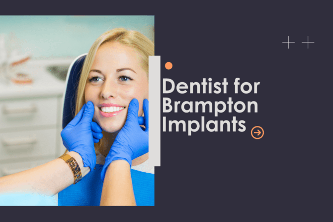How to Choose the Right Dentist for Brampton Implants