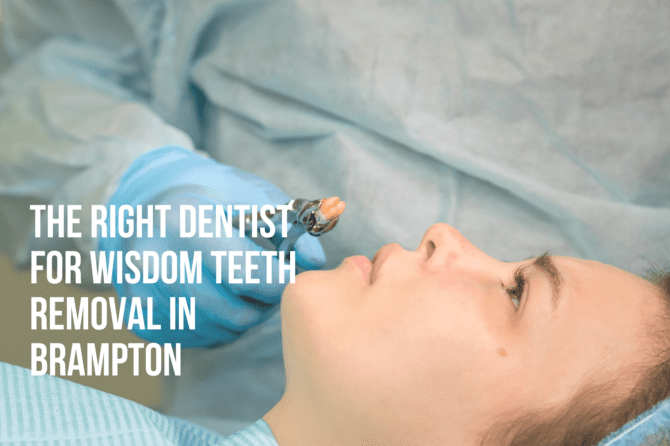 Choosing the Right Dentist for Wisdom Teeth Removal in Brampton